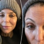 Bethenny Frankel comparte foto de 'frente arrugada sin botox'