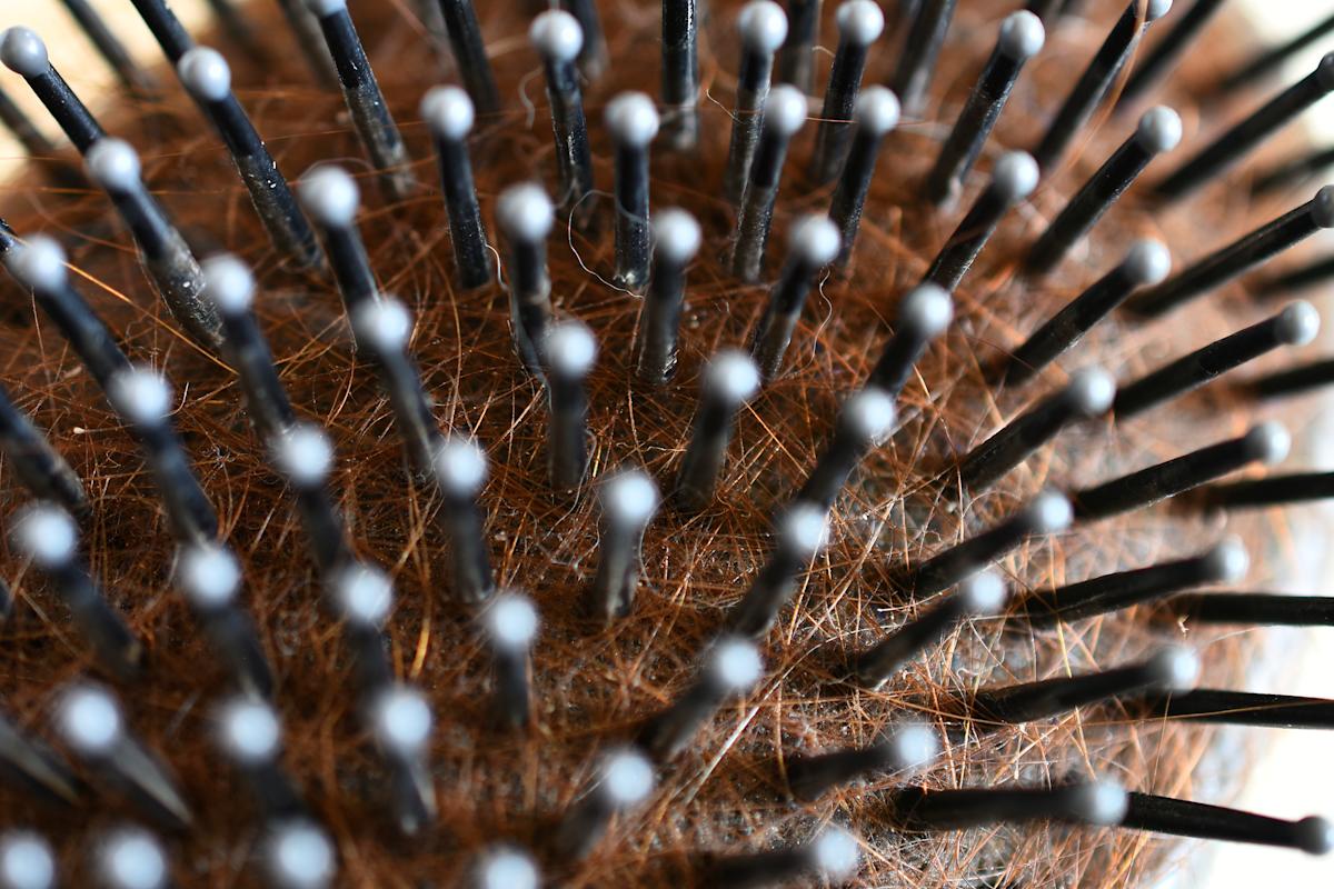 "Esto es asqueroso": la mugre que guarda el cepillo y el peine puede afectar tu cuero cabelludo