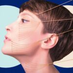 La Nueva Cirugía Plástica “Slow”: Lo Último en Tratamientos de Belleza Mínimamente Invasivos