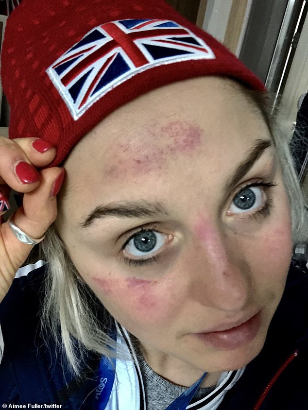 ¡Ay!  Aimee Fuller, de 30 años, reveló que abandonó su carrera de snowboard después de un accidente 'brutal' en los Juegos Olímpicos de Invierno de 2018 que la dejó 'afortunada de estar de una pieza'