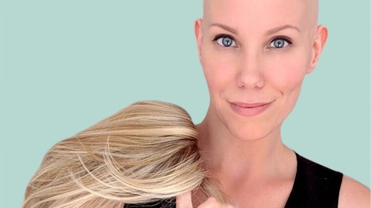 La actriz Jannica Olin comparte su viaje personal viviendo con alopecia: "¿Cómo puede convertirse esto en mi superpoder?"