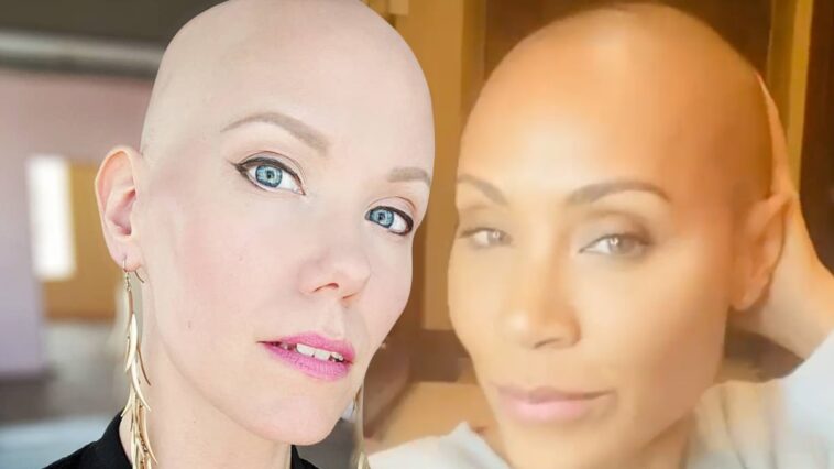 'La rubia calva de Hollywood' Jannica Olin sobre la alopecia, la broma de Chris Rock
