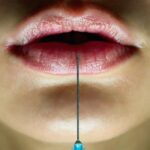 Recibí una "volteo de labios," Alternativa de relleno de labios de TikTok