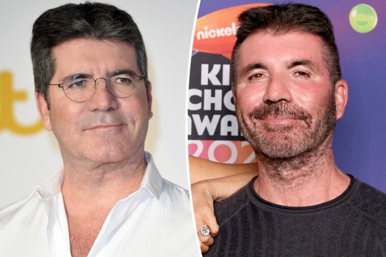 Simon Cowell ha terminado con Botox y rellenos en la cara