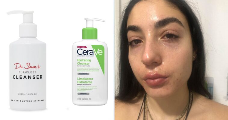 Estoy tomando Accutane y estos son los productos que salvan mi piel seca