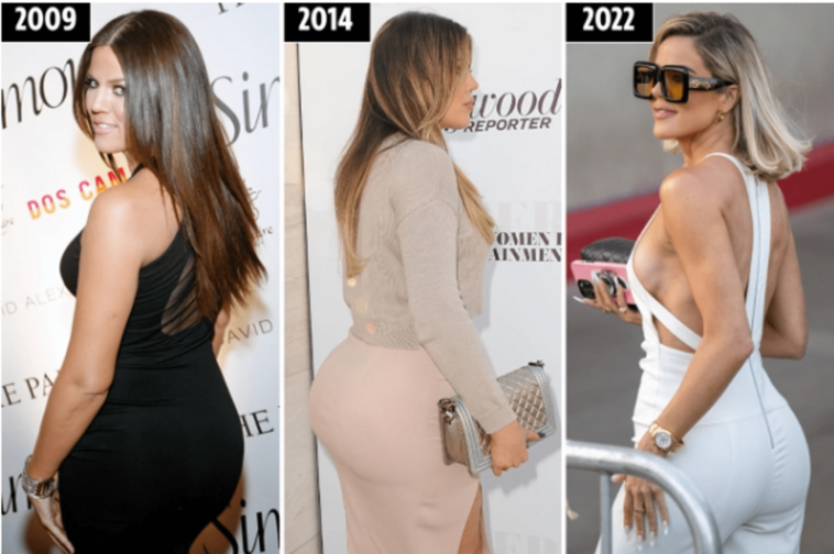 Los fanáticos de Khloe Kardashian sospechan que se deshizo de los implantes en las nalgas