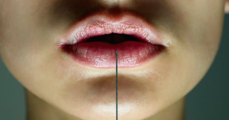 "carpa de labios": La nueva tendencia Buzzy New Filler de la que todo el mundo está hablando