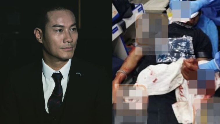 El actor de Hong Kong, Jason Wong, a quien a menudo se le llama “Imitación de Louis Koo”, recibe 100 puntos en la cara después de ser atacado en un restaurante