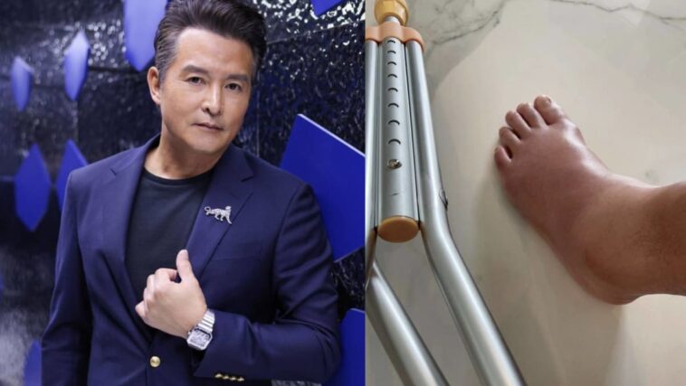 Christopher Lee se lesiona el tobillo;  No puede asistir a los Golden Bell Awards en Taiwán por segundo año consecutivo