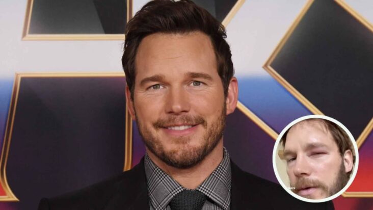 chris pratt picado en el ojo por una abeja después de ver viral bee lady: «creo que también puedo controlar las abejas»