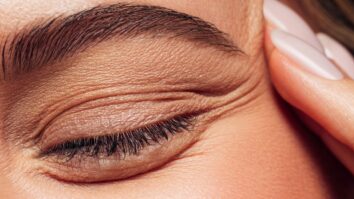 resulta que el retinol puede ayudar a tratar el acné